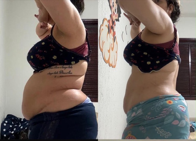 Antes e depois de perfil: barriga de uma aluna antes e depois do desafio